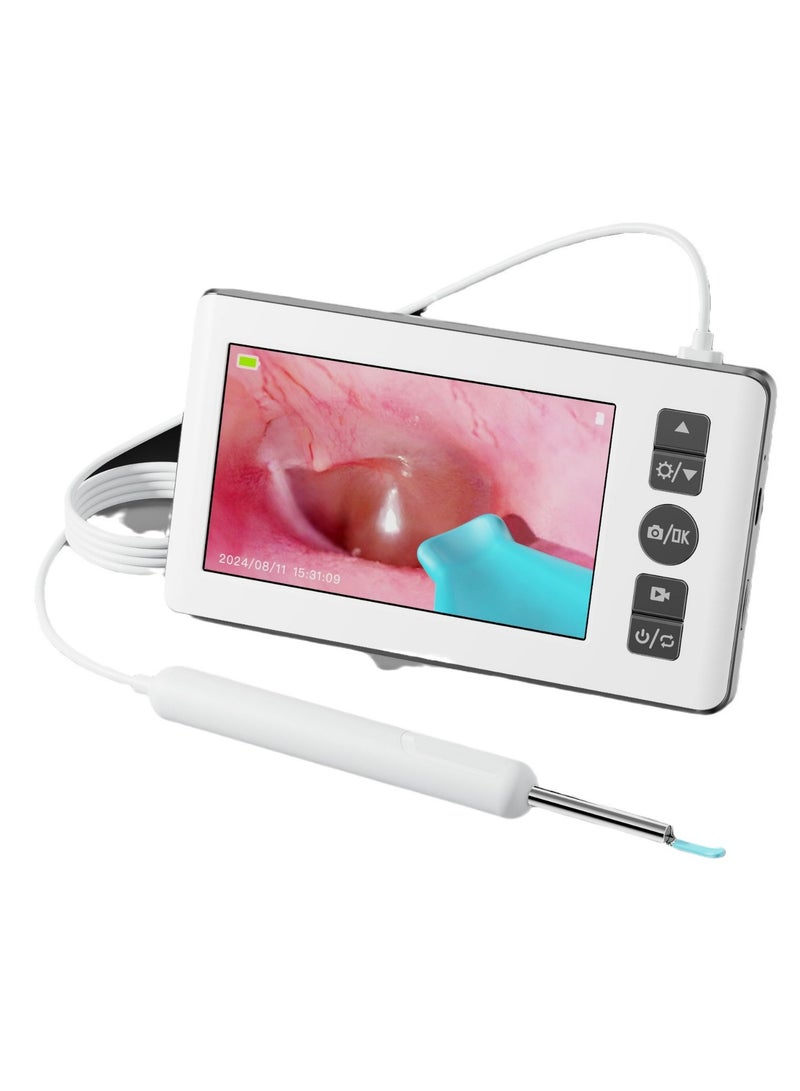 general Visual Ear Cleaning Kit with Screen HD Digital Ear Pick Memory Card Supported Type-C Rechargeable - Image 3
